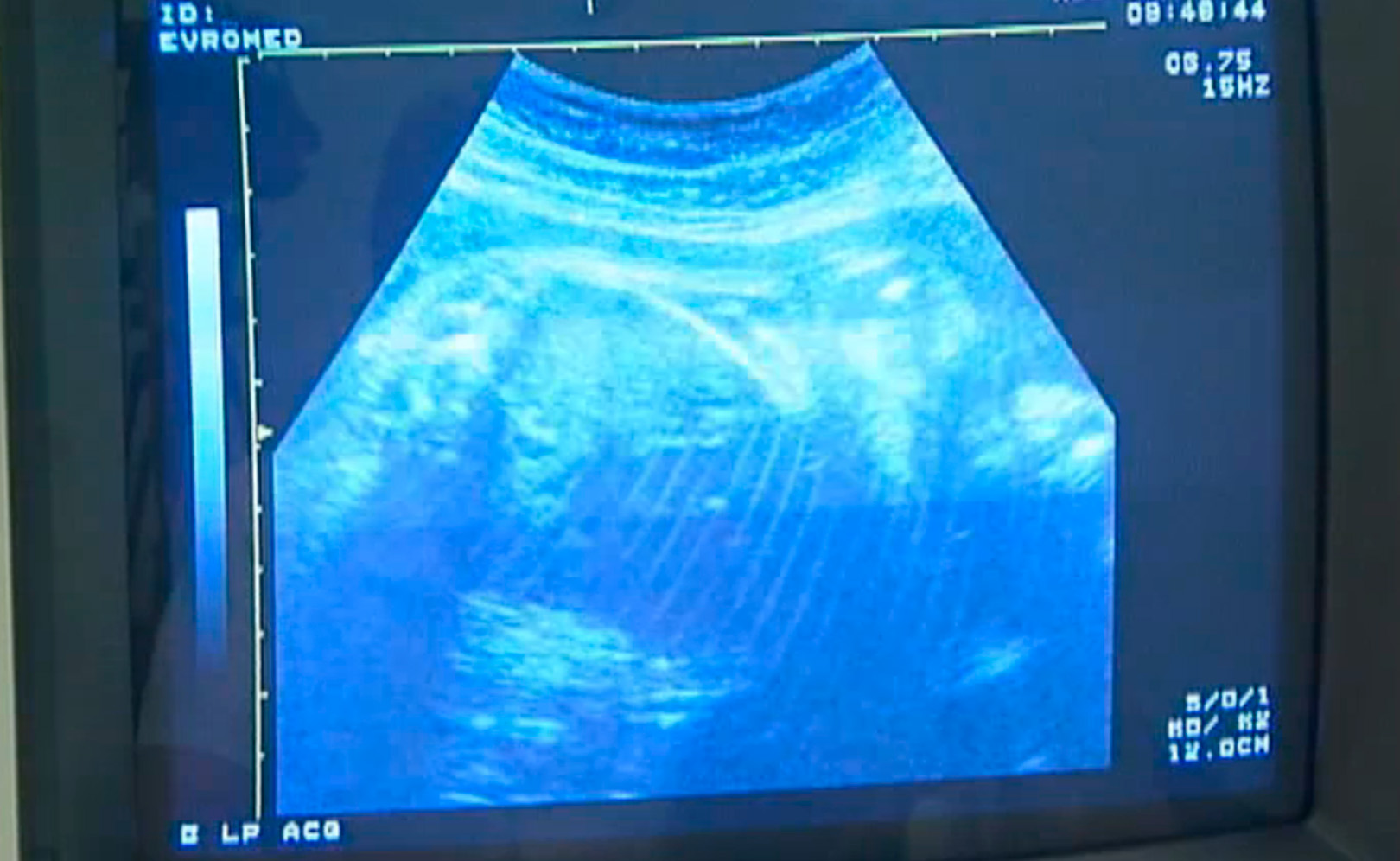 В интересном положении. Сезон 1